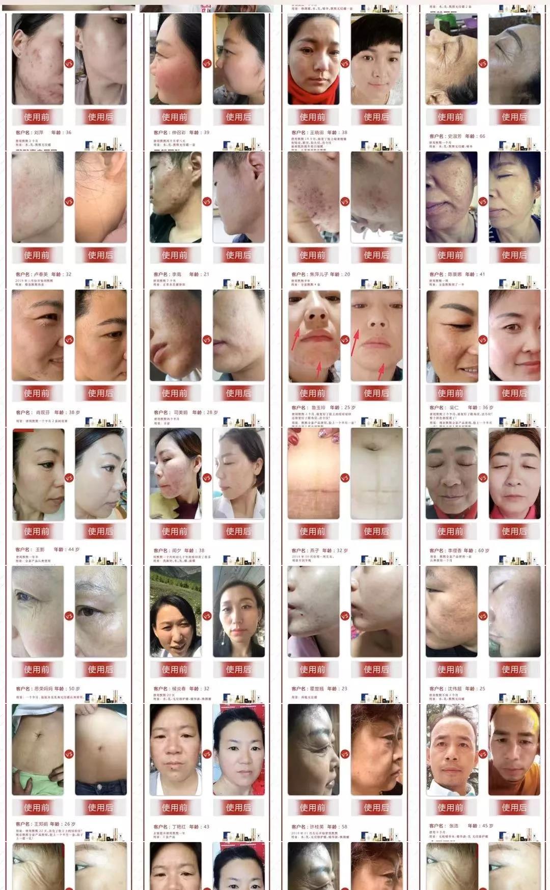 1582267767857524.jpg 凯发k8国际登录护肤品